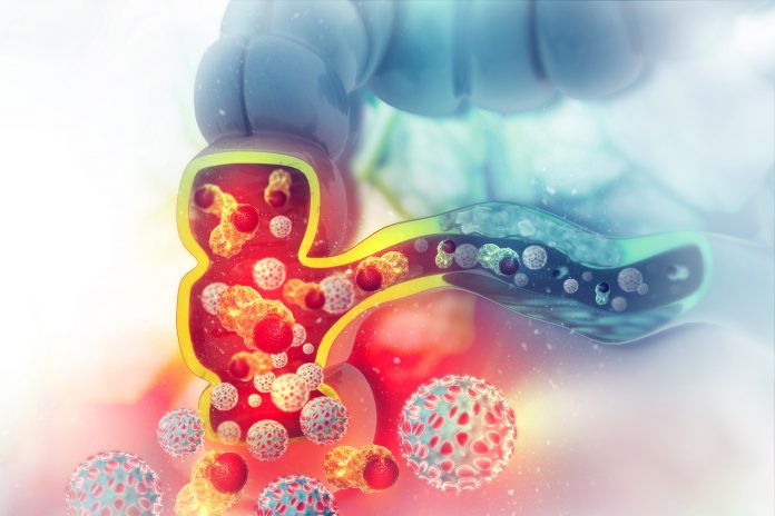 Novel cell death gene signatures predict colorectal cancer prognosis